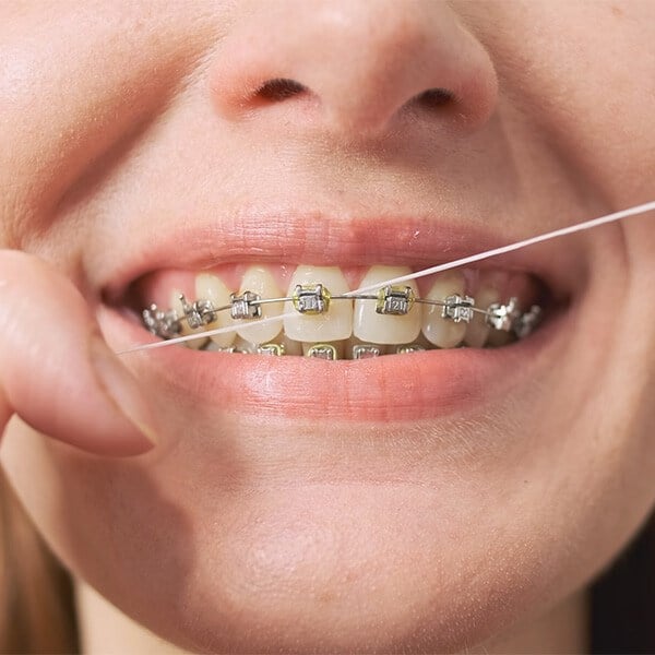 Flossing